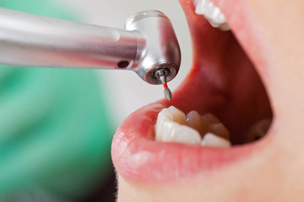 Best Emergency Denture Repair in Bristol, CT